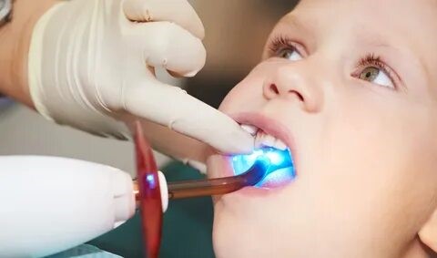 Пломбирование молочных зубов