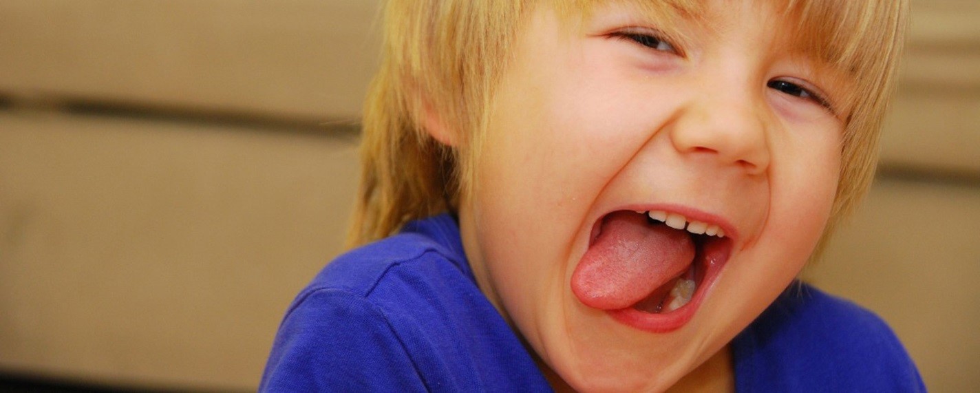 Пластика уздечки языка и губы у детей