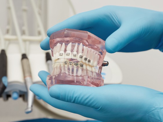dentist-showing-dental-plastic-m (7)